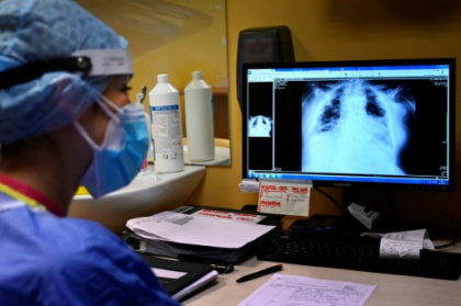TB cases rise after years of decline.jpg TB cases rise after years of decline.jpg