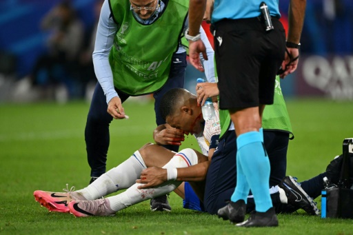 Mbappe breaks nose in France Euro 2024 win