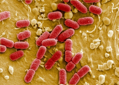 Drug-resistant superbugs projected to kill 39 million by 2050.jpg