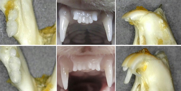 Japanese researchers test pioneering drug to regrow teeth