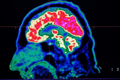 Microplastics are everywhere, but data is still lacking about how they could be affecting our brains - Fred TANNEAU (AFP) Microplastics are everywhere, but data is still lacking about how they could be affecting our brains - Fred TANNEAU (AFP)