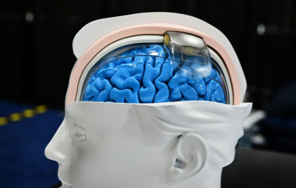Are brain implants the tech of the future? Some think neurotech could be as revolutionary as AI - Frederic J. BROWN (AFP)